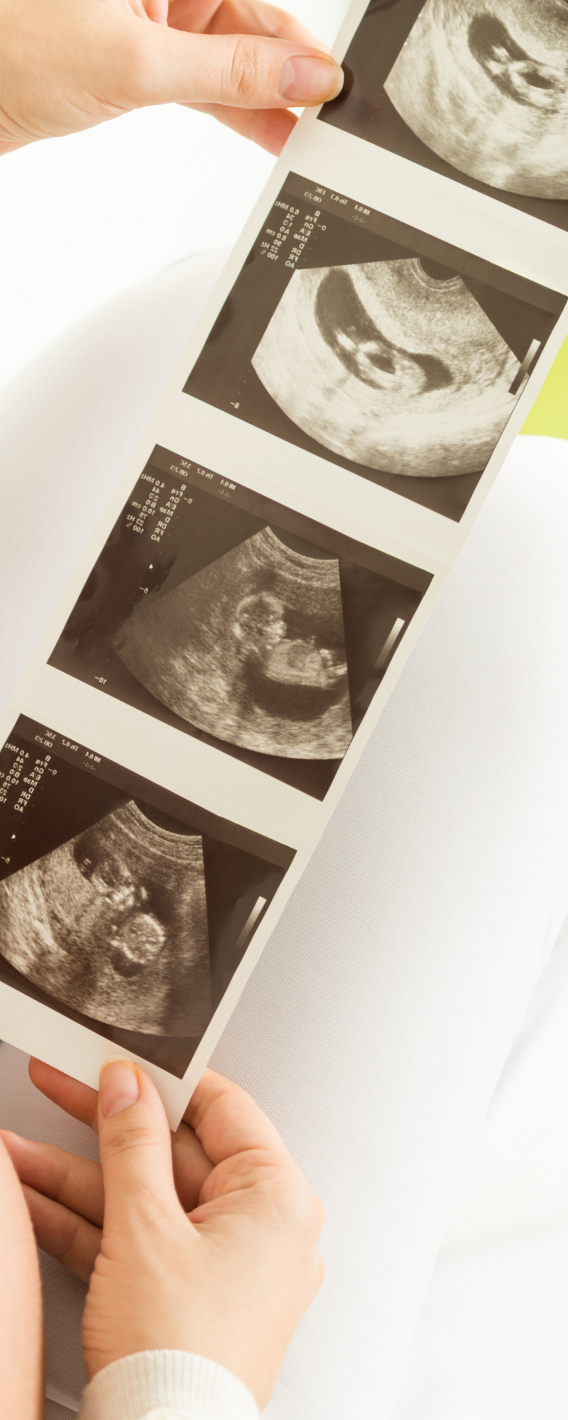 ultrasound images of a baby