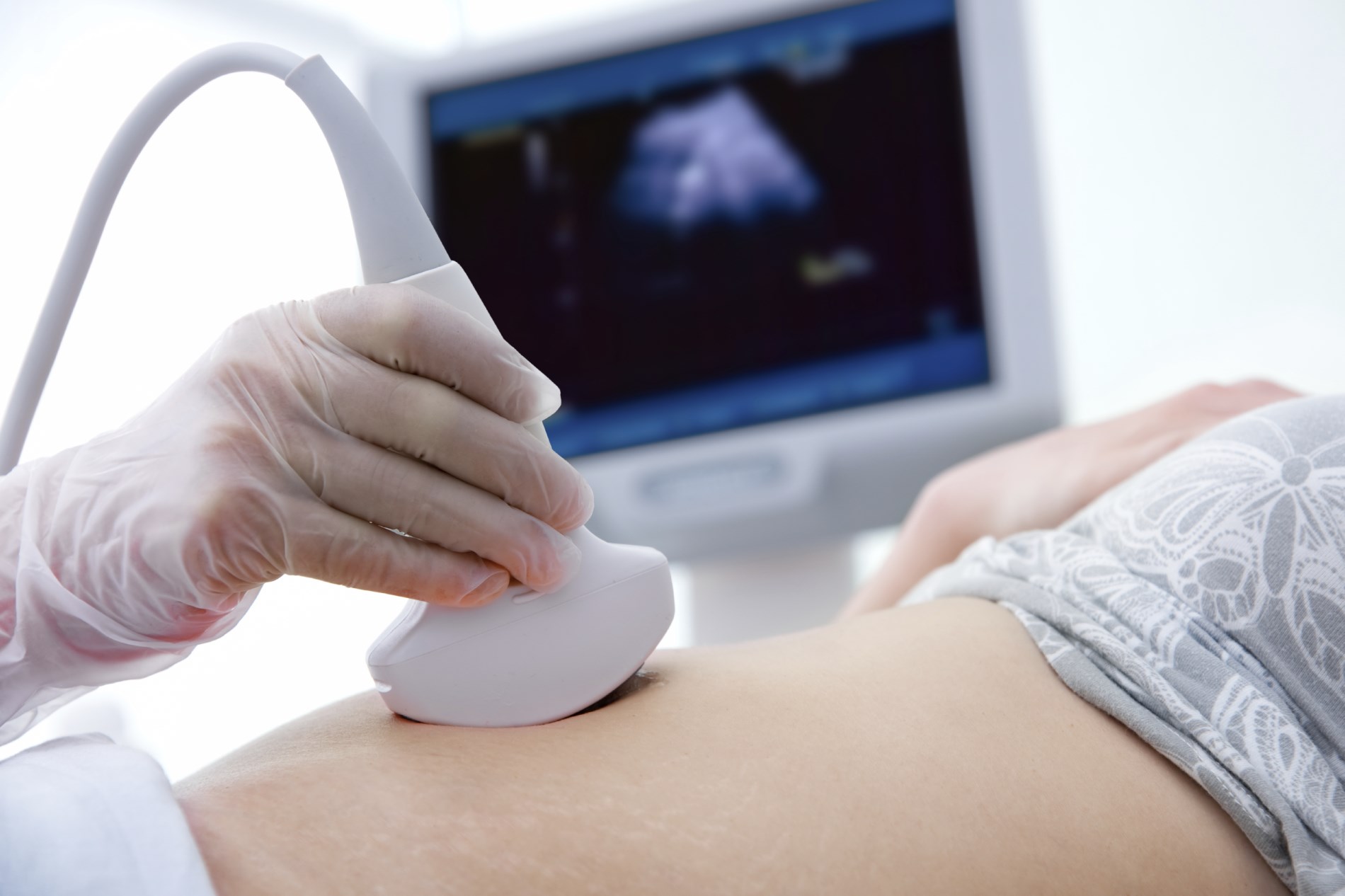 ultrasound probe on belly